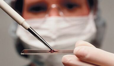 Diagnostic différentiel des attributs et de l'arthrose