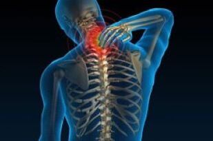 L'ostéochondose cervicale entraîne des douleurs au cou