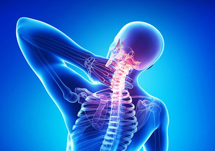 L'ostéochondrose de la colonne vertébrale est une maladie qui affecte le cartilage articulaire et les vertèbres.